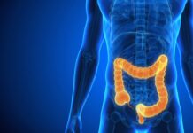 Crohn Hastalığı Nedir